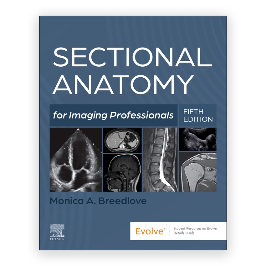 Sectional Anatomy for Imaging Professionals 5th edition by Breedlove